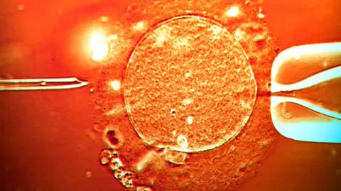 Stock photo: Embryologist uses a micro-needle to inject sperm into an egg during IVF (ICSI).